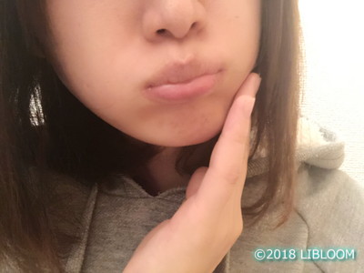 レビュー Mtg リファカラット Pec L1706 私のフェイスラインへの効果は Libloom